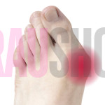 Защита при вальгусной деформации с гелевой вставкой, размер универсальный-шт., Fresco (Испания)