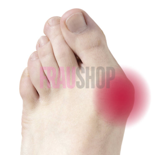 Защита при вальгусной деформации с гелевой вставкой, размер универсальный-шт., Fresco (Испания)