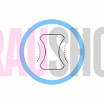 Вставка між 1 і 2 пальцями (висока) - L шт.