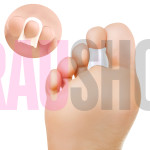 Кільце з гелю для вирівнювання молоткоподібних пальців - шт. Fresco (Іспанія)